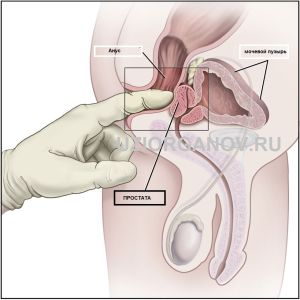 Трансректальное УЗИ предстательной железы (простаты) у мужчин