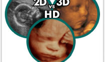 3Д УЗИ при беременности: что такое 3d, вредно ли трехмерное УЗИ