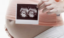 Беременная с УЗИ снимком